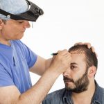 Hair Transplants in Chicago Can Restore Your Youthful Looks